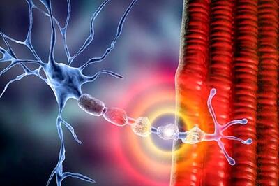  درمان ام‌اس با سلول‌های ضدسرطان؛ امیدی نو برای بیماران