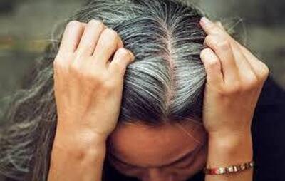  یافته‌ای جدید درباره سفید شدن مو