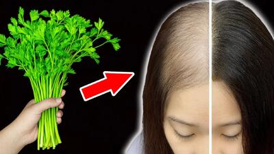  قوی ترین دستور طبیعی برای توقف ریزش مو که واقعا معجزه می کنه