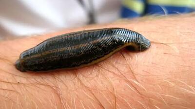  دیدن زالو در خواب چه معنایی دارد؟ | اقتصاد24