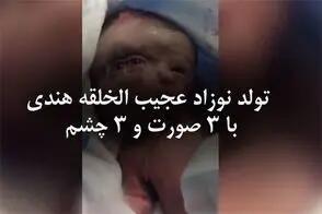  تولد نوزاد عجیب الخلقه هندی با ۳ صورت و ۳ چشم/ویدیو