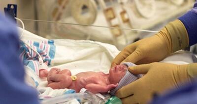  غربالگری بینایی بیش از ۱۰۰۰ نوزاد نارس خوزستان در نیمه نخست سال جاری