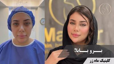  آزادی بعد از ۷۰ 😌💄 ( کلینیک زیبایی ماه زر )