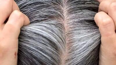  چگونه موهای خاکستری به جلوگیری از سرطان پوست کمک می‌کنند؟