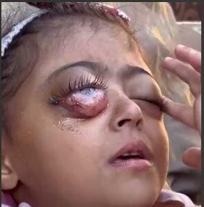  اسرائیل هم کودکیش را دزدید هم چشمانش را !