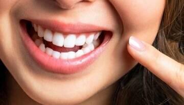  خوراکی‌های مفید برای سلامت دندان