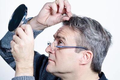  سفید شدن مو؛ نشانه‌ای پنهان از سرطان پوست؟