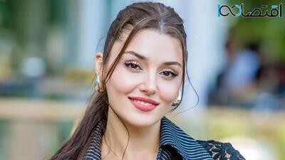  تاریخ وبگردی | تغییر چهره «هانده ارچل» بازیگر سریال ترکی عشق حرف حالیش نمیشه