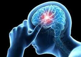  در تومور مغزی کجای سردرد میگیرد ؟ هرآنچه باید بدانید