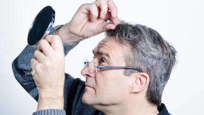  ارتباط بین سفید شدن موها و ابتلا به سرطان