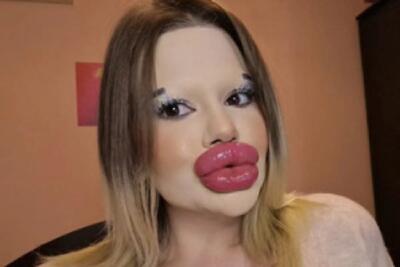  تاریخ وبگردی | این زن بزرگترین لب و استخوان گونه جهان را دارد