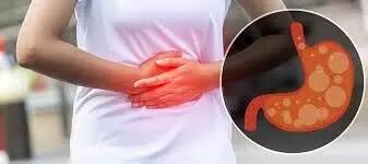  خطرات نگه داشتن باد معده