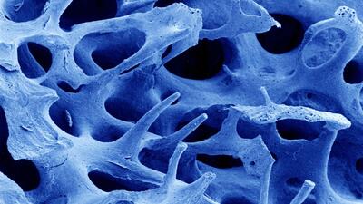  استخوان هم حافظه دارد، مراقب باشید چه به آن می‌دهید!