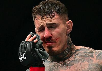  ضربه به چشم؛ مشکل ریشه‌دار و آزار دهنده در UFC و MMA - تسنیم