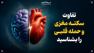  تفاوت سکته مغزی و حمله قلبی را بشناسید