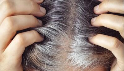  خاکستری‌شدن موها احتمالاً رویکرد طبیعی بدن برای مقابله با سرطان است