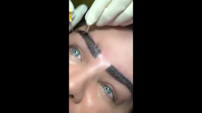  کاشت ابرو نمونه کار
