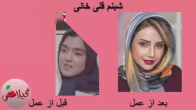  بازیگران زن ایرانی که صورتشان را جراحی کردند! (قبل و بعد شوکه‌کننده)