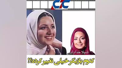  راز تغییر چهره بازیگران زن سینمای ایران فاش شد! (قبل و بعد)