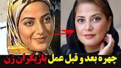  این بازیگران زن ایرانی چهره خود را تغییر دادند! (قبل و بعد باورنکردنی)