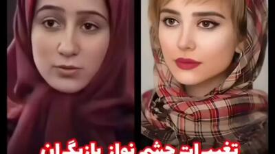  عکس های باورنکردنی از بازیگران زن ایرانی قبل و بعد از عمل زیبایی