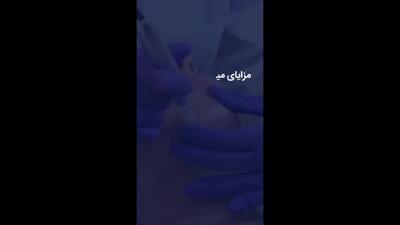  مزایای میکرونیدلینگ
