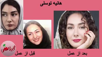  جراحی زیبایی بازیگران زن ایرانی؛ شکست یا موفقیت؟ (مقایسه تصویری)