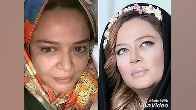  از لیپوتراپی تا بلفاروپلاستی؛ جراحی‌های زیبایی محبوب در بین بازیگران