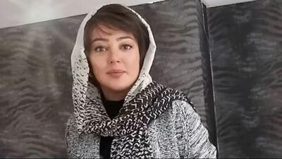  راز چهره واقعی رزیتا غفاری قبل از جراحی‌های زیبایی