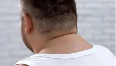  اندازه گردن چه چیزی در مورد سلامتی شما می‌گوید؟
