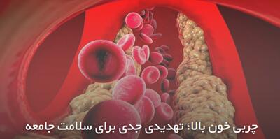  چربی خون بالا؛ تهدیدی جدی برای سلامت جامعه