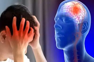  مراجعه سریع به بیمارستان کلید درمان مؤثر سکته مغزی است