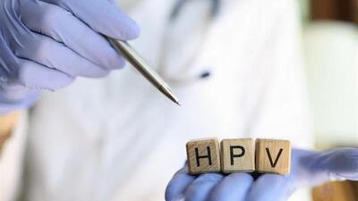  روش مناسب برای تشخیص تغییرات دهانه رحم در بیماران «HPV»