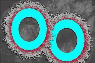  نابودی بیش از ۸۰ درصدی تومورهای تخمدان با نانوذرات جدید