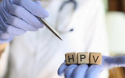  روش مناسب برای تشخیص تغییرات دهانه رحم در بیماران «HPV»