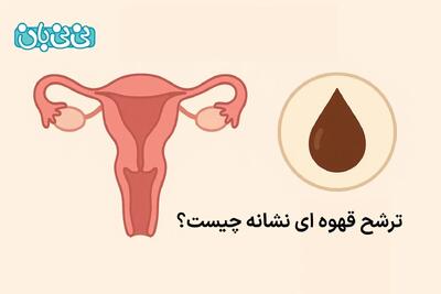  ترشحات قهوه ای واژن نشانه چیست؟ ۳ علت و روش‎‌های درمان
