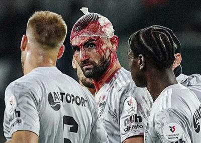  شکستگی سر وحشتناک سردار در دیدار باشاک‌شهیر