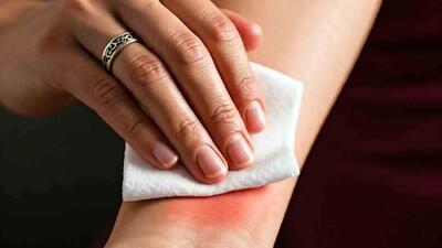  نشانه‌ های حساسیت به طلا و بهترین راه‌ حل‌ های درمانی