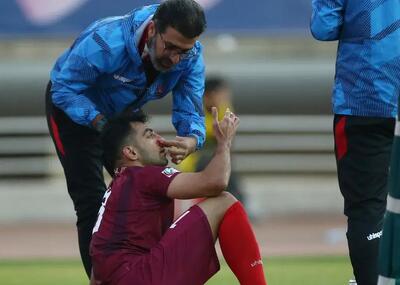  خبر بد در روز خوب نساجی