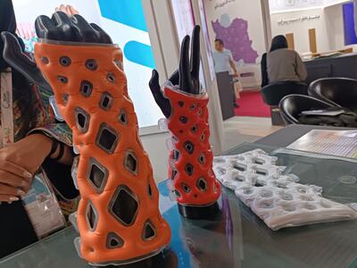  نوآوری ایرانی در درمان شکستگی‌ها /گچ نانویی ضدآب و ضدحساسیت تولید شد