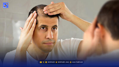  چهار توصیه مهم برای کسانی که ریزش مو دارند