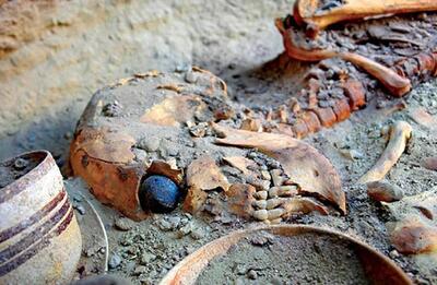  کهن‌ترین پروتز جهان در «قوطی کبریت» نگهداری می‌شود!