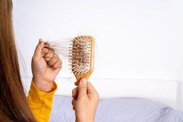  چهار توصیه برای کسانی که ریزش مو دارند