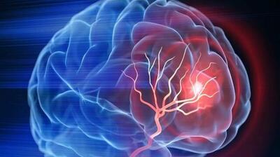  میگنا - آلزایمر همیشه ارثی نیست؛ مراقبت‌های روزمره نقش کلیدی دارند