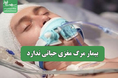  بیمار مرگ مغزی حیاتی ندارد