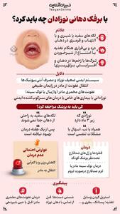  راهنمای والدین برای برفک دهانی در نوزادان