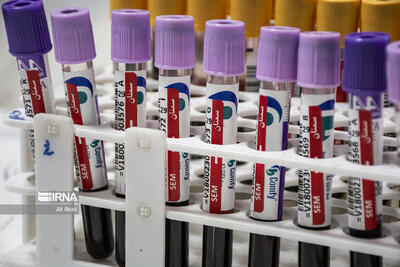  تفسیر نتایج آزمایش‌های پزشکی باید فقط توسط پزشکان انجام شود، نه هوش مصنوعی