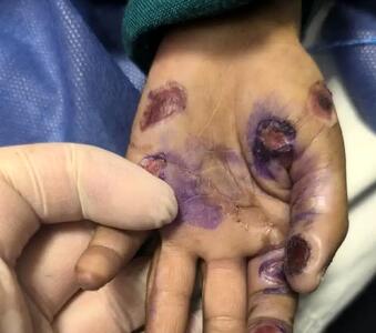  مرگ تلخ کودک 4 ساله بر اثر کودک آزاری