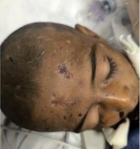  ماجرای مرگ کودک ۴ساله بر اثر کودک آزاری/ خانواده ادعا کرده‌اند؛ کودک از بالای درخت افتاده/عکس‌های +18