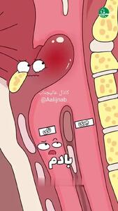 مرگ در یک جرعه؛ وقتی چای داغ را با نوشیدنی سرد قاطی می‌کنید! + فیلم